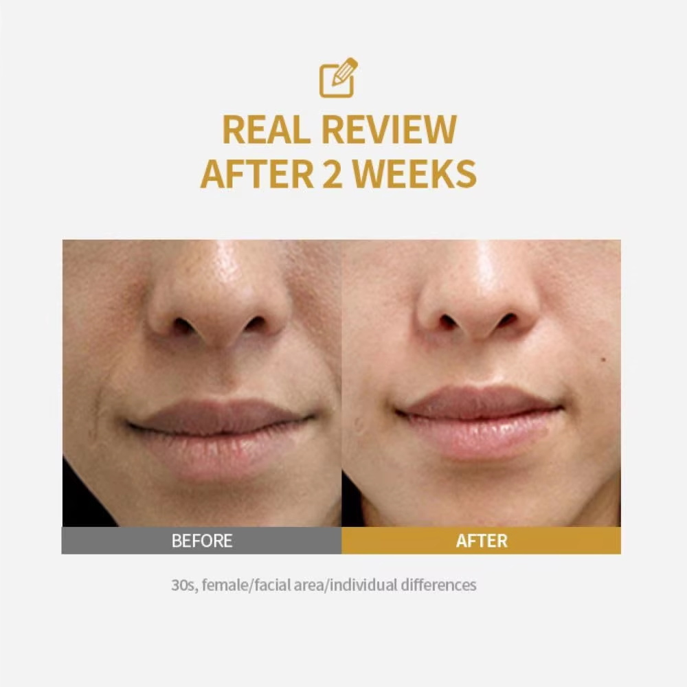أمبولة رفع مكثفة من الببتيد، م - مراجعة Peptide Complex Serum وسعره